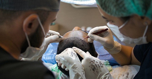 Tyrkiets hårtransplantationsindustri: En blomstrende sektor til at genoprette dit selvværd
